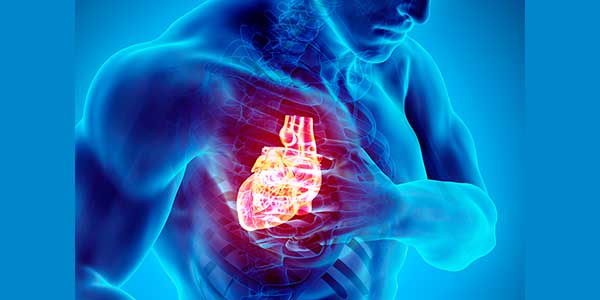 parada-cardiorespiratoria