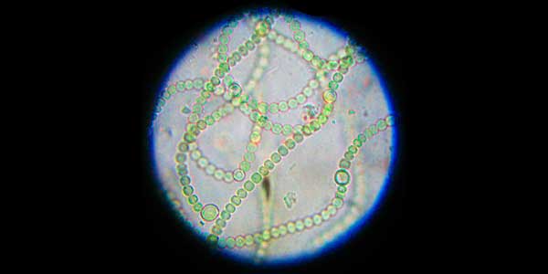 Cianobacterias 1 cianobacterias
